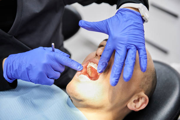 Best Emergency Wisdom Tooth Extraction in Bartlett, TX
